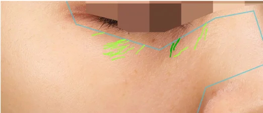 MYTREX PROVE | トータルリフト美顔器 -