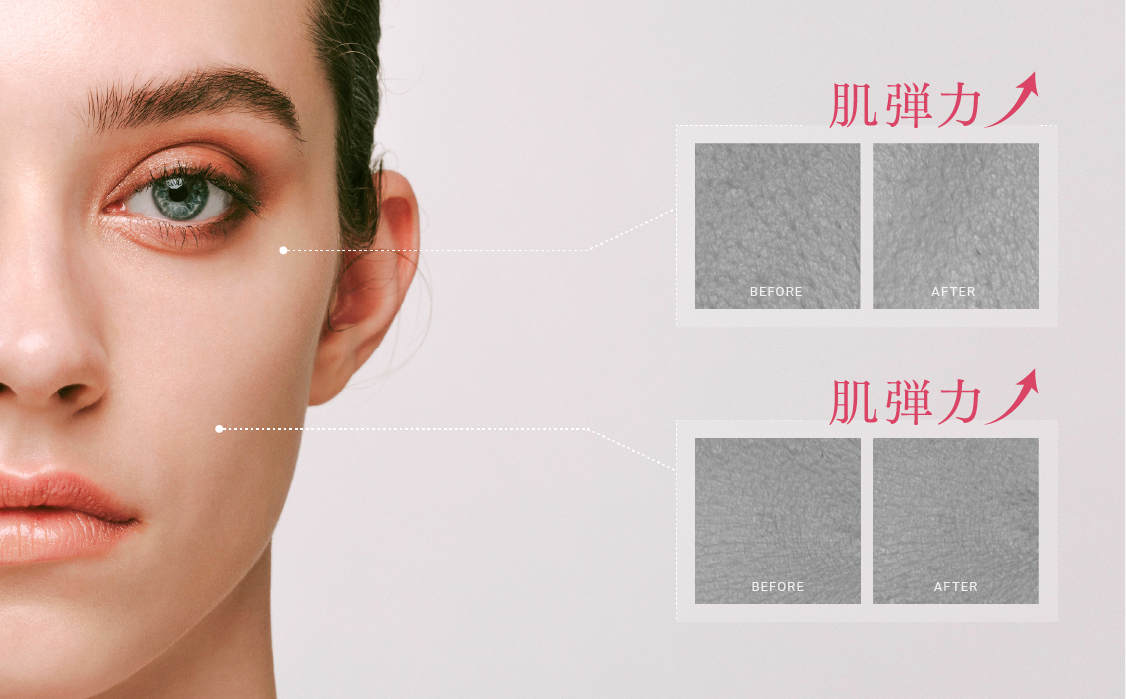 MYTREX PROVE | トータルリフト美顔器 -