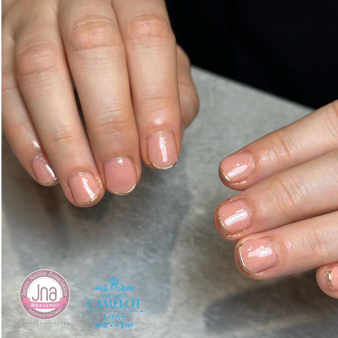 深爪矯正専門サロンに もっと早く来ればよかった！ （M 様） | 深爪