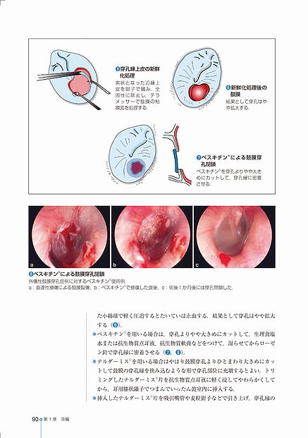 ENT臨床フロンティア | 株式会社中山書店