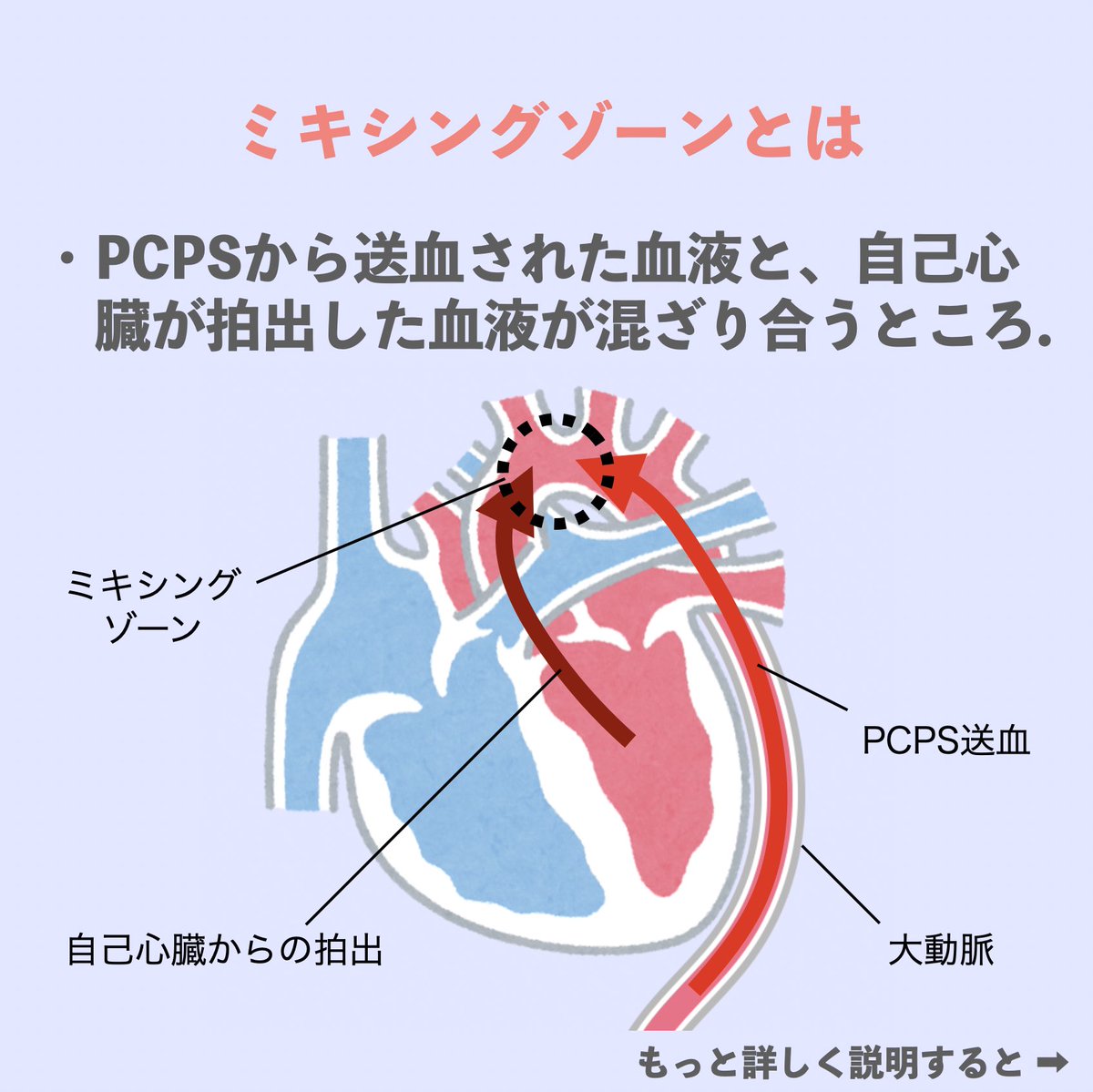 PCPS(VA-ECMO)のミキシングゾーンについて教えて下さい！ と質問された