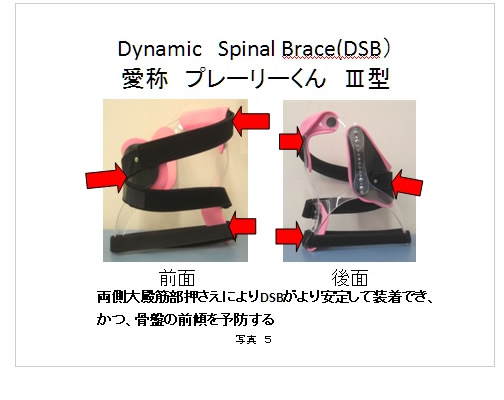 医療に従事する方へ | 医療用装具側弯矯正装具プレーリーくん | 社会