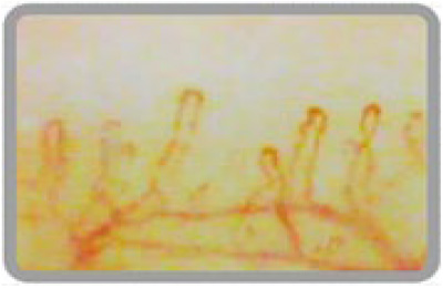 有用な毛細血管観察方法 | NPO法人 QOLサポート研究会