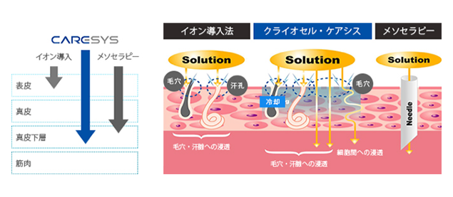 ケアシス・イオン導入 | すがも小林皮フ科