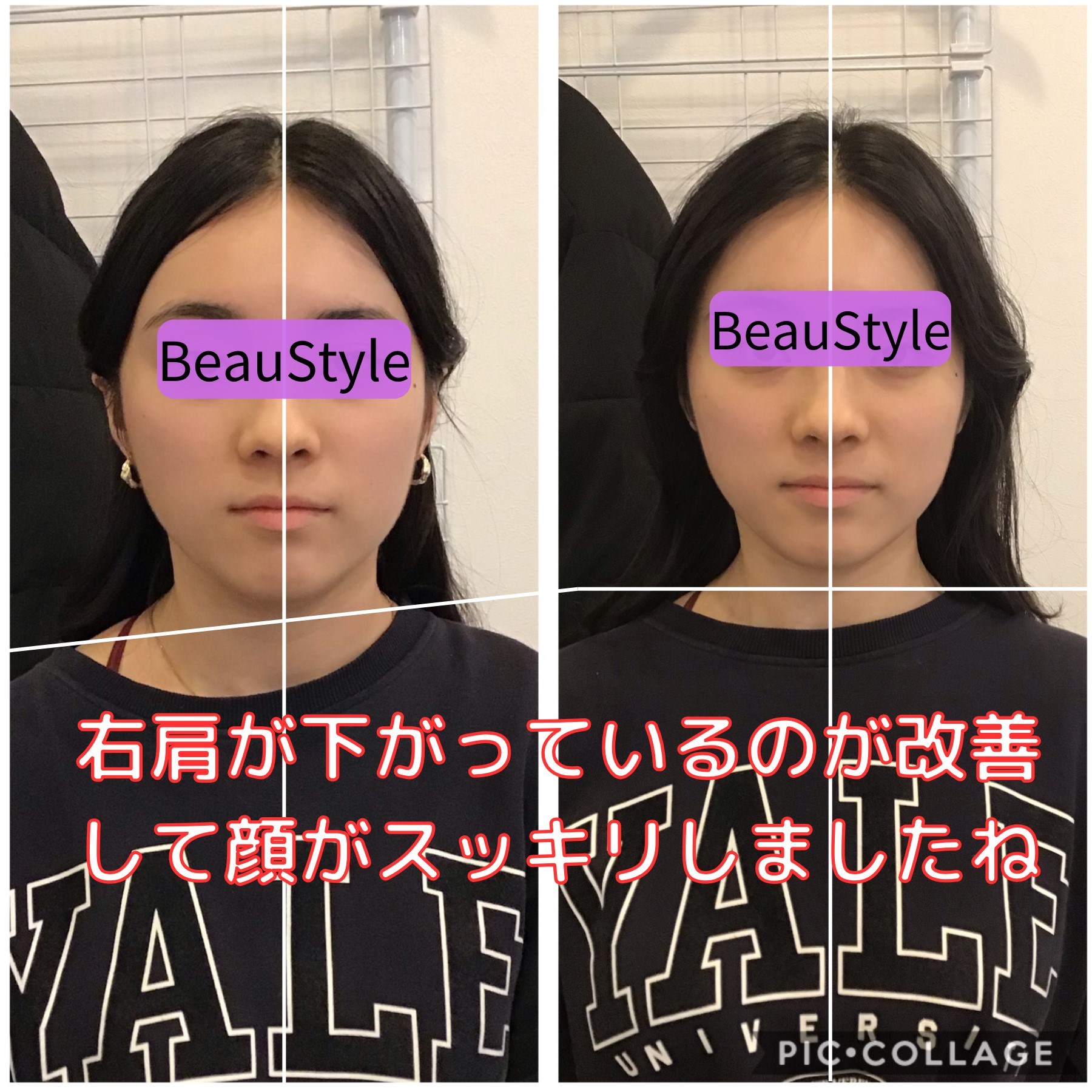 小顔矯正＋骨盤矯正で顔の歪み・左右非対称をケア｜大阪の『ビュー