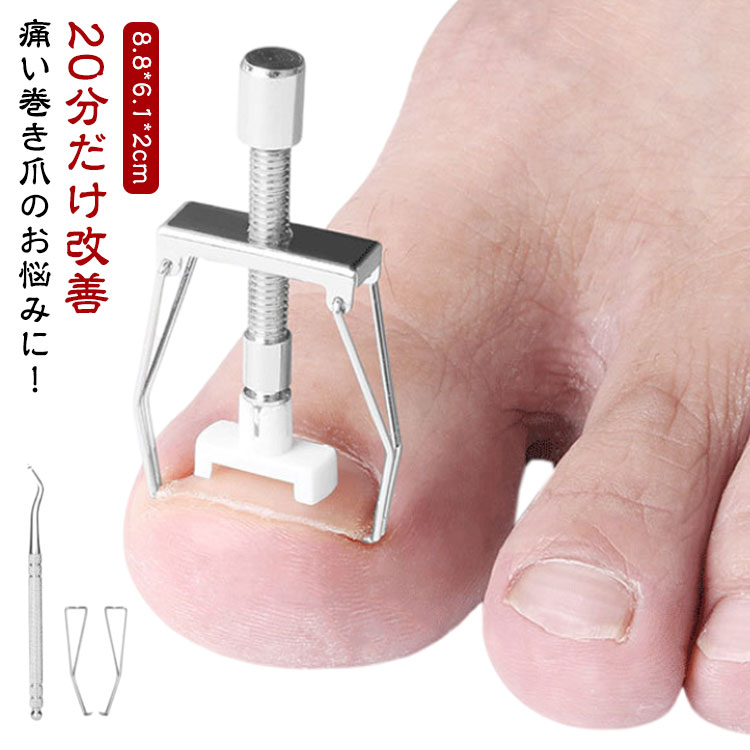 楽天市場】巻き爪 矯正 セット サポート 器具 20分だけ改善 ネイルケア