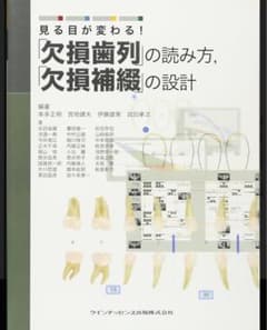 裁断済 見る目が変わる！ 「欠損歯列」の読み方，「欠損補綴」の設計