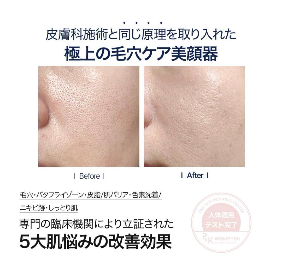 CELORABY PENTASHOT 美顔器セット ペンタショット セラロバイ - メルカリ