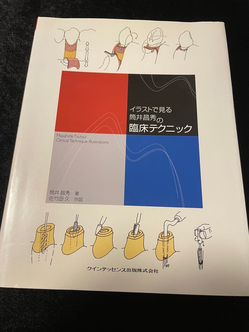 イラストで見る筒井昌秀の臨床テクニック包括歯科臨床