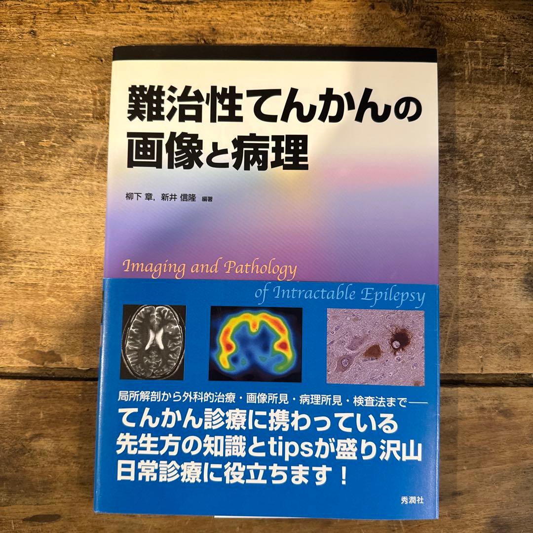難治性てんかんの画像と病理 難治性てんかんの外科治療 | 公益社団法人 日本てんかん協会