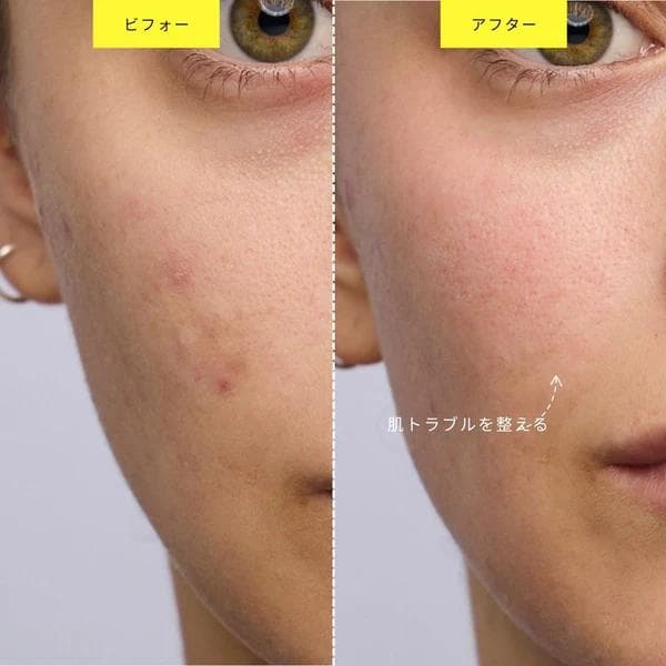 ZIIP DOT (ハイテク美顔器)の通販はau PAY マーケット - 輸入雑貨の